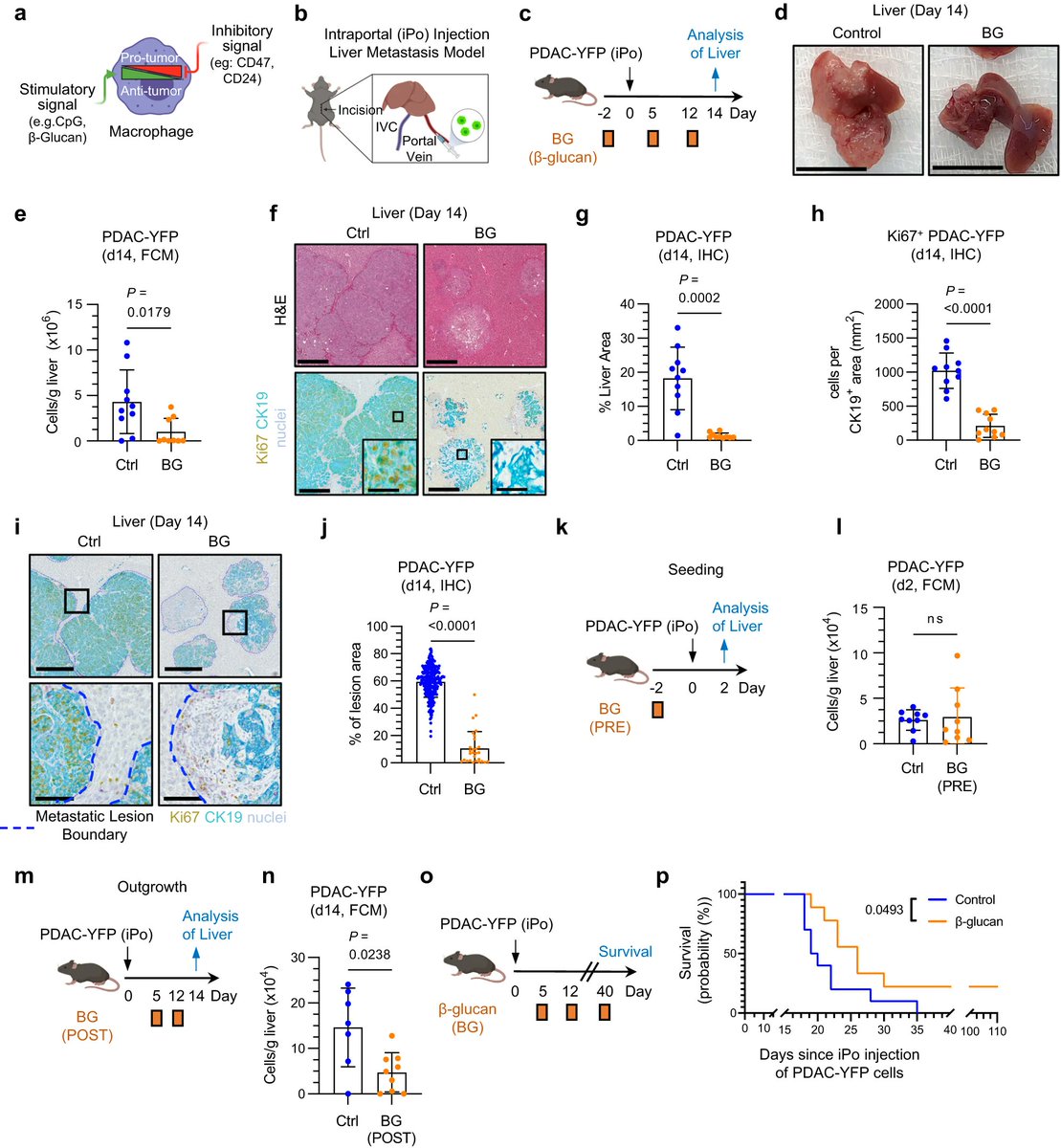 PennMedCSO's tweet image. Kupffer cells prevent pancreatic ductal adenocarcinoma metastasis to the liver in mice ft. Stacy Thomas, @mmwatt02, @shaantichoibose, Heather Coho, Christopher Cassella, Meredith Stone, Dhruv Patel, Kelly Markowitz, Devora Delman &amp;amp; @LabBeatty tinyurl.com/mrytyyyz