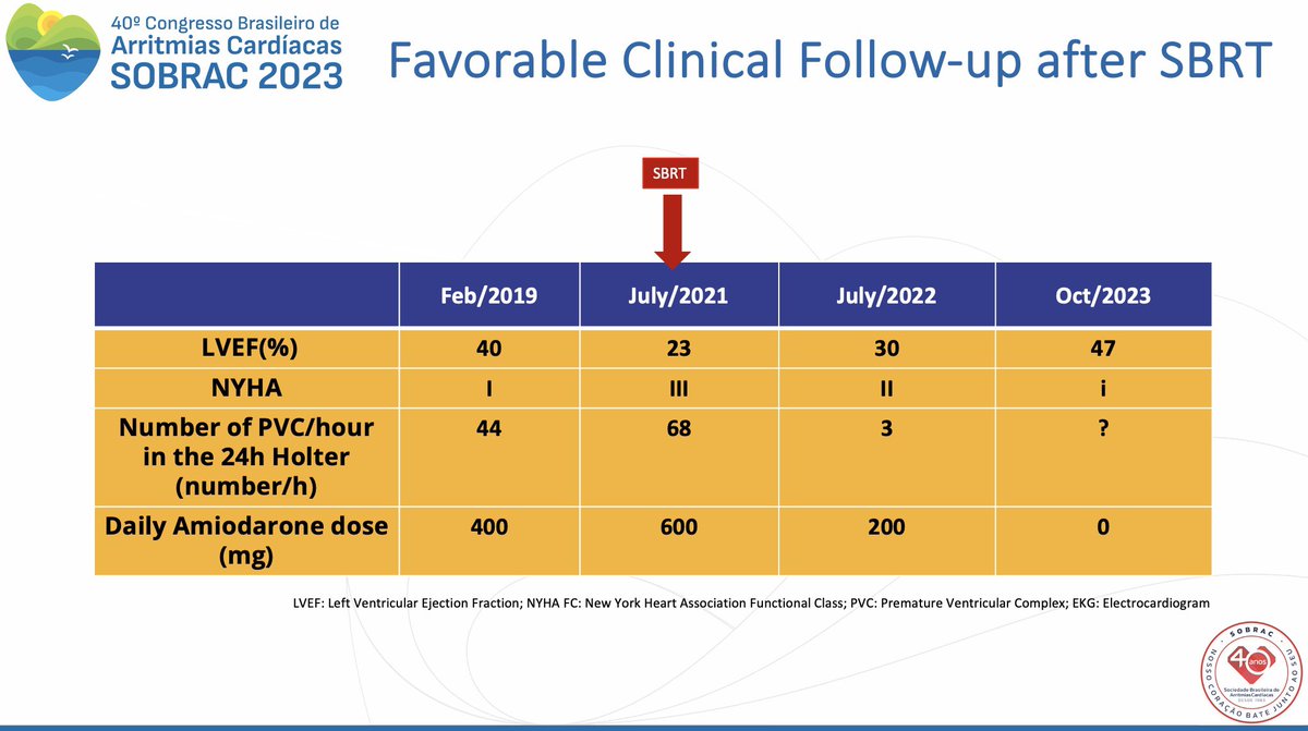 Rodrigo Kulchetscki (@rodrigomk2101) on Twitter photo I am really excited with this… our first patient with Chagas Disease that underwent SBRT in July/21 now had a better LVEF than before (and also no recurrence)! Any thoughts?<a href="/DoctorPhillEP/">Phillip Cuculich, MD</a> <a href="/crpisani/">Cristiano Pisani</a> <a href="/Scanav1Mauricio/">Mauricio Scanavacca</a> <a href="/besalva/">Bernardo Salvajoli</a> <a href="/EPeeps_Bot/">EP_Bot</a> <a href="/SobracO/">SOBRAC</a> I am really excited with this… our first patient with Chagas Disease that underwent SBRT in July/21 now had a better LVEF than before (and also no recurrence)! Any thoughts?<a href="/DoctorPhillEP/">Phillip Cuculich, MD</a> <a href="/crpisani/">Cristiano Pisani</a> <a href="/Scanav1Mauricio/">Mauricio Scanavacca</a> <a href="/besalva/">Bernardo Salvajoli</a> <a href="/EPeeps_Bot/">EP_Bot</a> <a href="/SobracO/">SOBRAC</a>