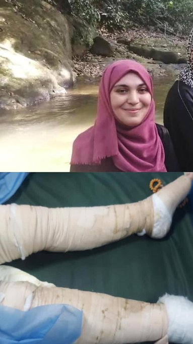 sahabatalaqsha's tweet photo. #UPDATE #Gaza 

Bayi kembar berusia 2 minggu ini bernama Samaa dan Lamaa. Ibu mereka, Maryam. 

Samaa dan Lamaa dibunuh Zionis, Jumat 1/12/2023.

Maryam luka bakar di hampir seluruh tubuhnya dan masih belum tahu bahwa kedua bayinya tewas.

@QudsNen https://t.co/bTGPGfWIvT