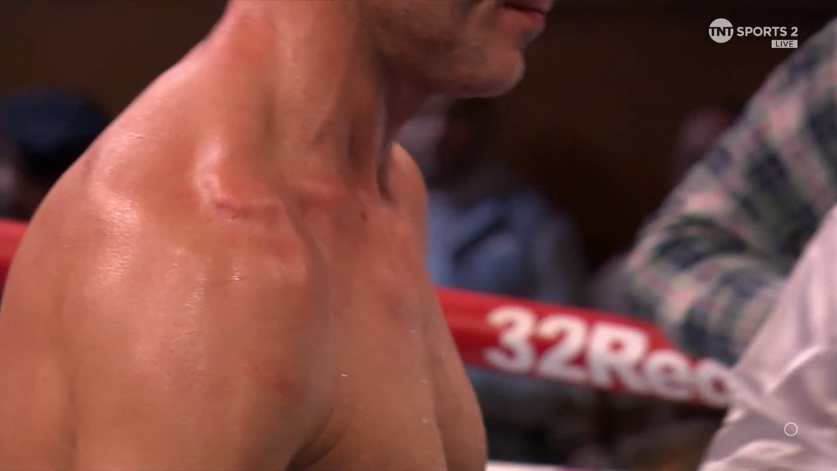 MrBoxingFacts's tweet photo. Injury stops play. You can see that is genuine. #boxing #GwynneMarsili #NoakesPerez https://t.co/1ctKnD0s2p