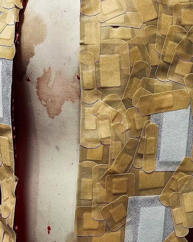 studiolemaine's tweet photo. wound, healing, scars https://t.co/M0XPoJQ9iw