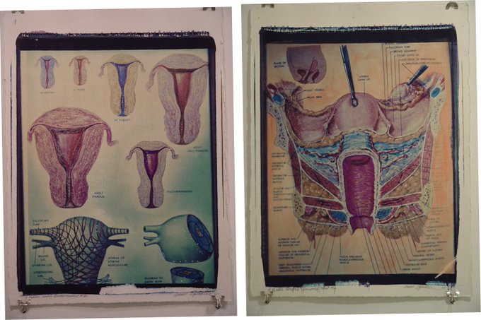 I'm proud of these large format polaroid transfer pieces I made and hand painted with nail polish. Made<a href="/tag/hate"class="tags"><span>#hate</span></a><a href="/tag/genocide"class="tags"><span>#genocide</span></a><a href="/tag/torture"class="tags"><span>#torture</span></a><a href="/tag/ceasefirenowpermanently"class="tags"><span>#ceasefirenowpermanently</span></a>