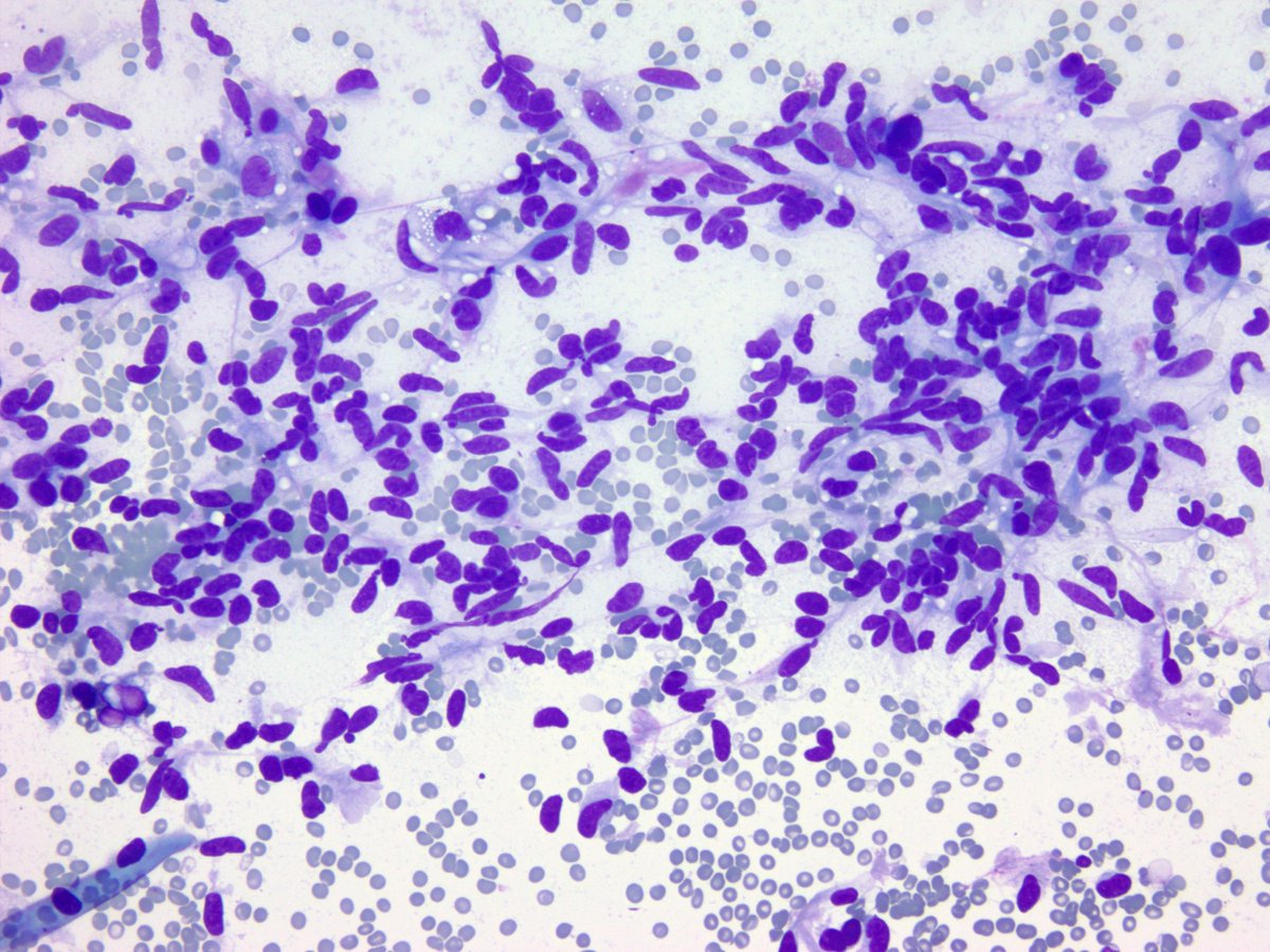 smlungpathguy tweet picture