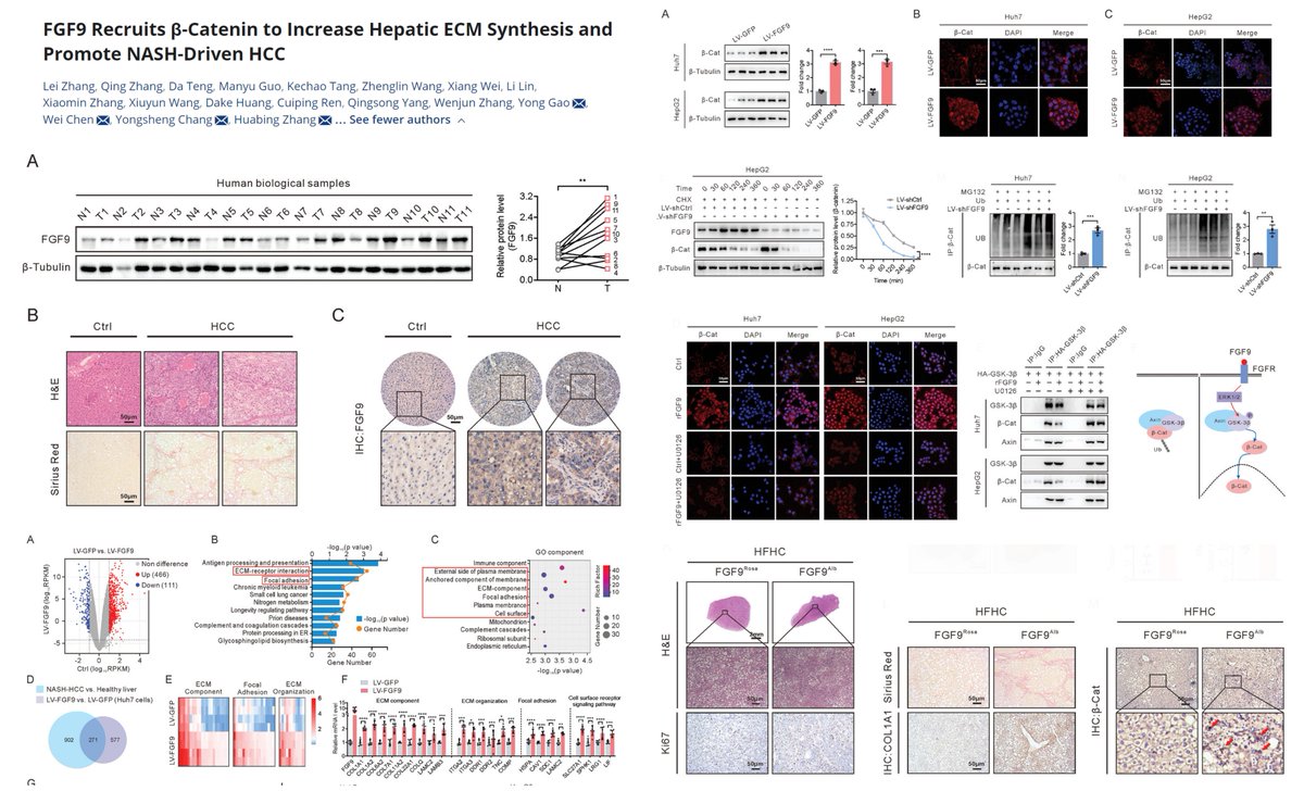 Lentiviral or Alb-Cre overexpression of #FGF9->
⏫Wnt signal
⏫#NASH-associated #HepatoCellularCarcinoma
via⏫ERK1/2 to⏬GSK3β-ubiquitin degradation of βCatenin 

Direct proliferative & fibrotic effects of FGF9 on hepatoma cells

#AdvSci 2023 @AdvSciNews
onlinelibrary.wiley.com/doi/10.1002/ad…