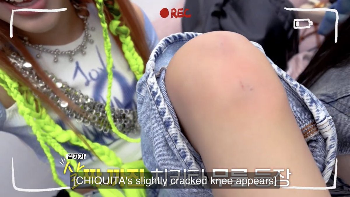baebemon's tweet photo. the reason Chiquita got slightly bruised on her knee bcs she was running and want to eat ㅜㅜㅋ be careful maknae ah~ https://t.co/p0tLtLa7mS