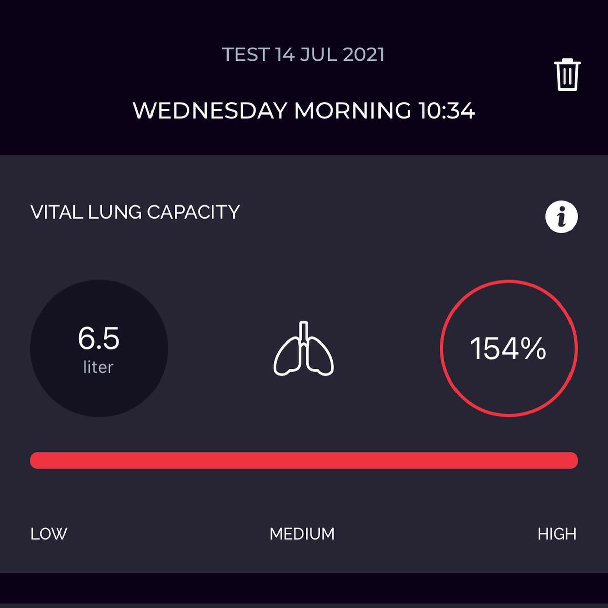 Bizitalk's tweet photo. I’m pretty happy right now. After using this device AND being on Kaftrio for a few months, I’ve just got my best lung function EVER at the age of 35! Full video now up on my YouTube ✌️https://t.co/YqfPWu96xN #cysticfibrosis #endurance #lungcapacity #cfwarriors
@joshlj24 #bizitalk https://t.co/55Dw7jTZgj