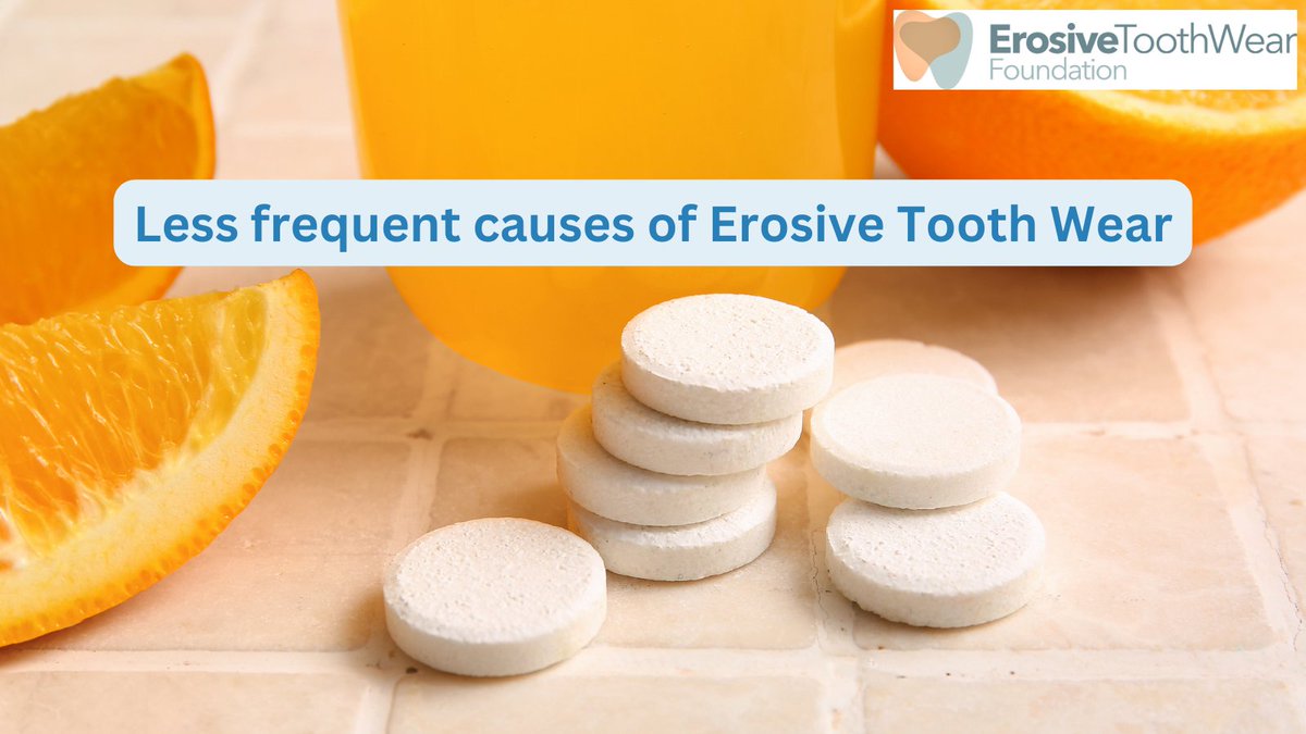 etwf2019's tweet photo. What could be causing your patient's Tooth Wear? 🦷 Chewable vitamin C tablets, aspirin &amp; some iron preparations are not such a common cause as dietary factors but can still play a part which is why it's vital to have an understanding of your patient's broader health issues. https://t.co/QGd5XNzXfO