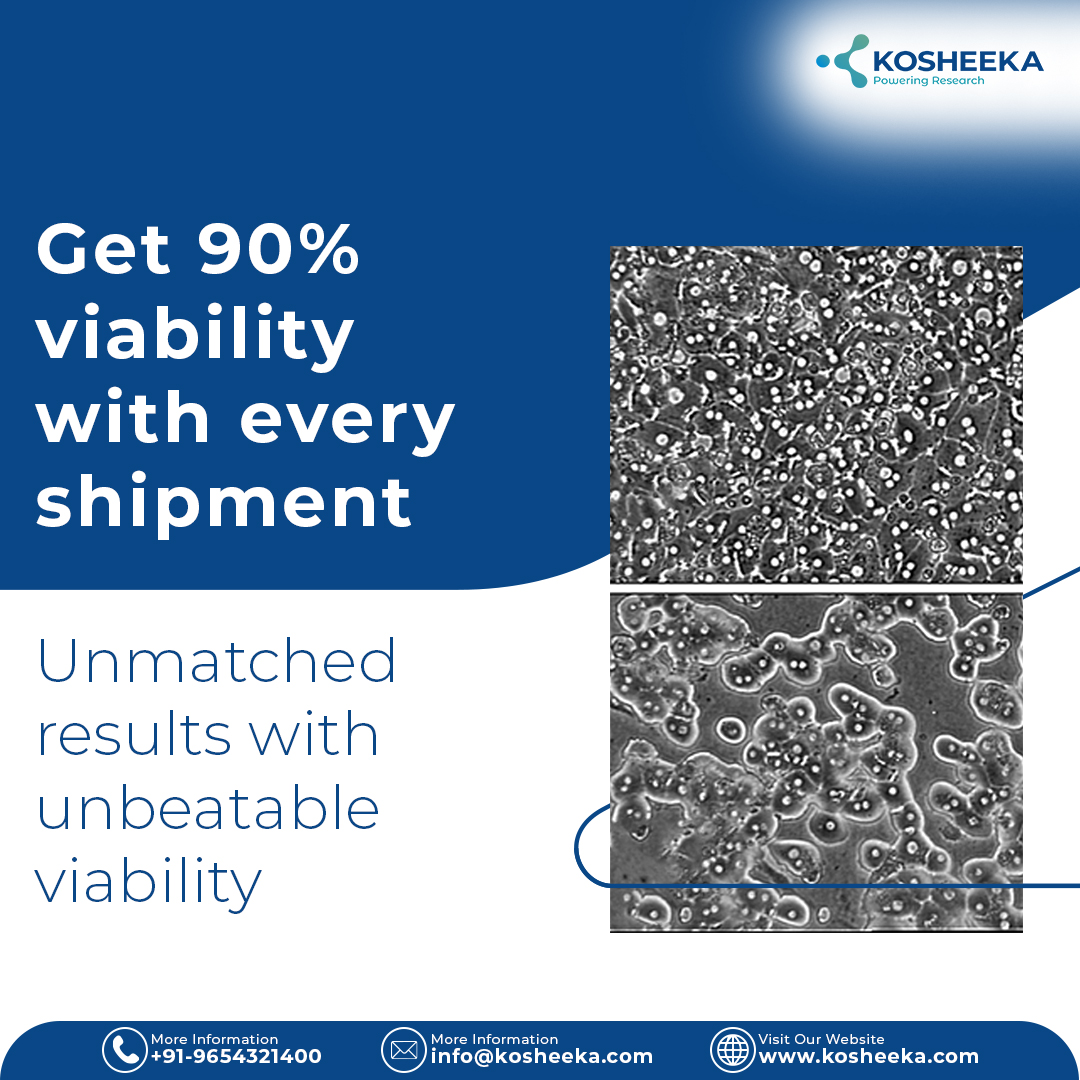 Unparalleled results with 90% viability on every primary cells shipment. 
Call +919654321400 for more information!

#primarycells #cellculture #biotechnology #medicalresearch #biotechinnovation #drugdiscovery #biopharma #cellresearch #kosheeka #research