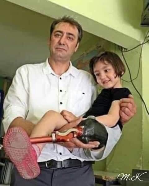 Yılın babası sen olmalısın.

Antalya'da 6,5 aylık dünyaya gelip, 13 günlükken sol bacağı kesilen 6 yaşındaki kızı Özge’nin yürüyebilmesi için evinin tavanına 150 TL'ye maliyetle kurduğu düzenekle kızına yürümeyi öğreten alüminyum doğrama ustası baba Ali İhsan Yıldırım, bu
++👇