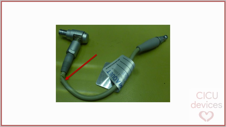 CicUdevices's tweet photo. 3. A notably number of breaks in the insulation sheath and the shielding of the cable has been observed.
The fracture may impact the control of extracorporeal support due to the lack or incorrect values communicated.
#ecmo #cardiohelp #icu #icunurse https://t.co/iZZsfOh8o6