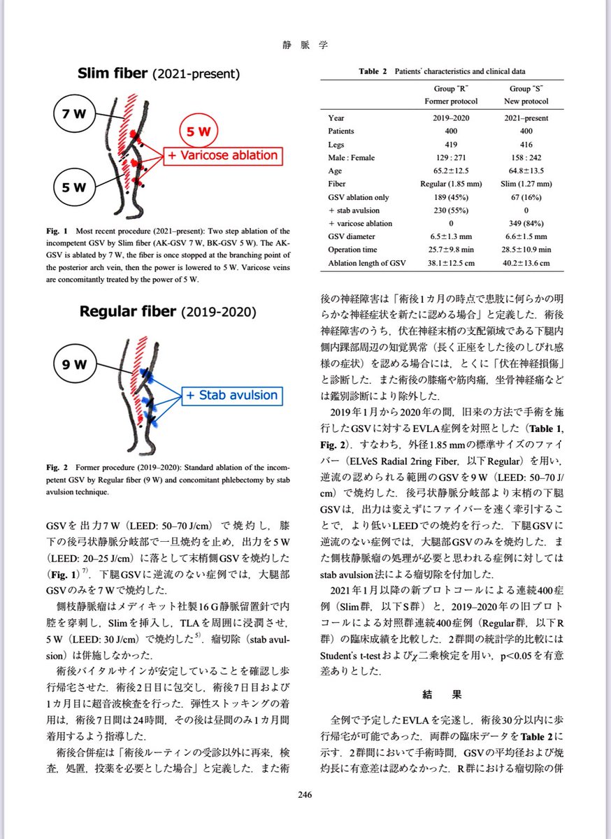 markzroland's tweet photo. It was exactly 1 year ago when I learnt #EVLA #laserablation from Prof Junichi Utoh, who is an outstanding vascular surgeon and continues to develop new techniques even after retirement.
2nd 📸 : his scanned original handwriting
3rd 📸 : directly explaining his technique to us https://t.co/OxOGKf4qhh