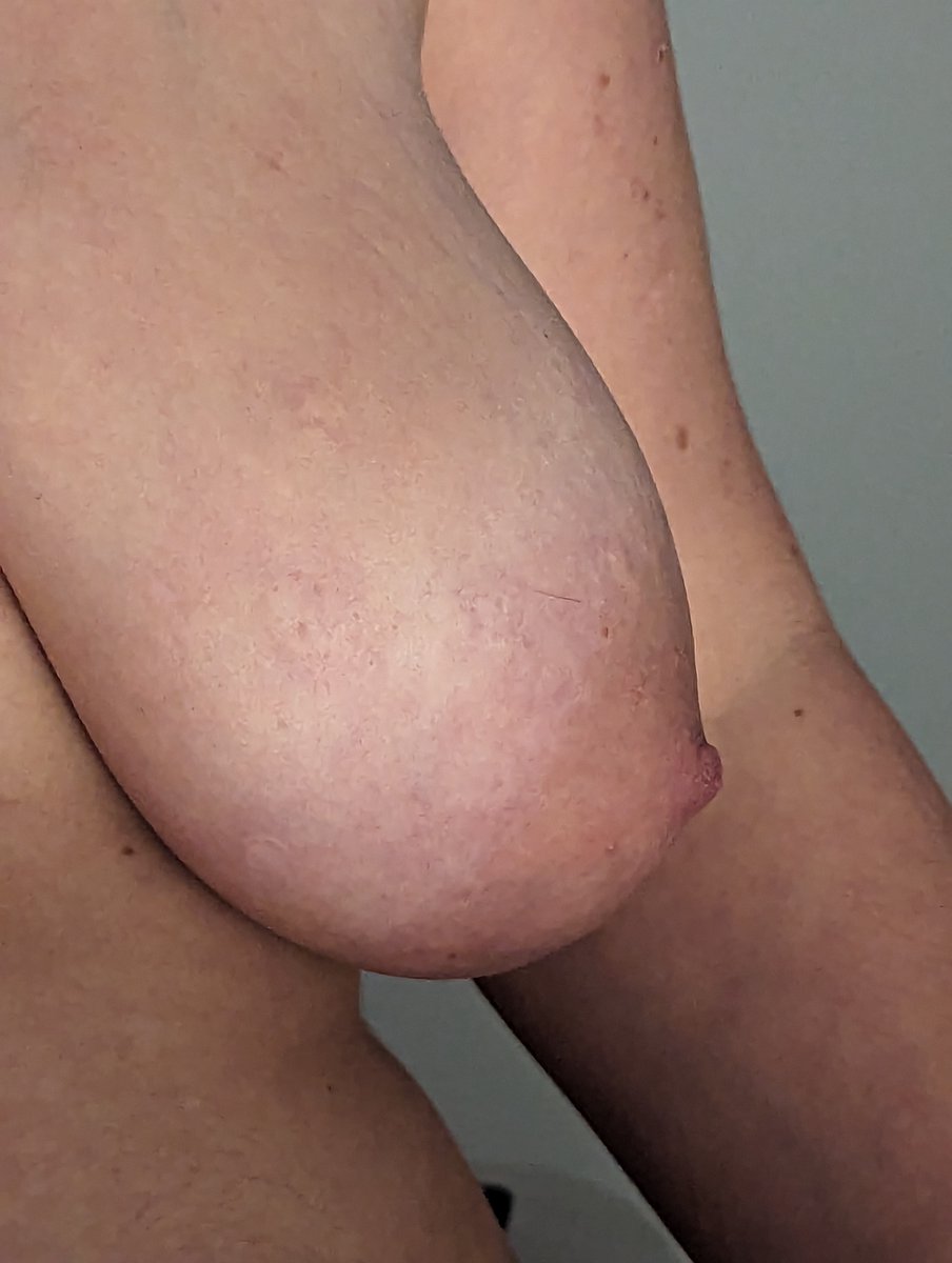 💗open_mind💗🇩🇪🇺🇲 tweet media