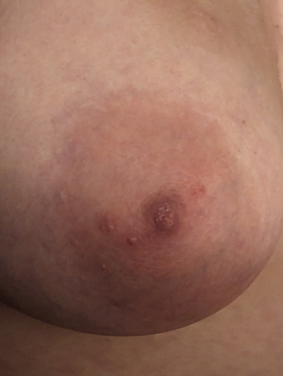 💗open_mind💗🇩🇪🇺🇲 tweet media