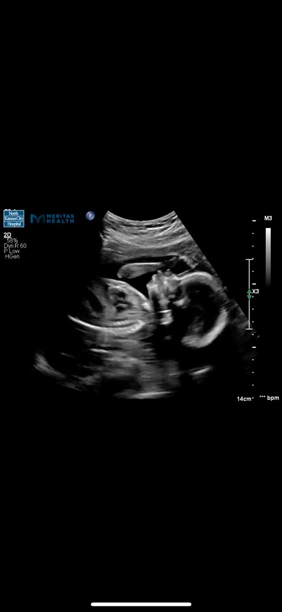 kendrickiscute_'s tweet photo. just realized i never posted on here that i’m having a son in february, surprise! 🤎 https://t.co/dA5VTseq7G