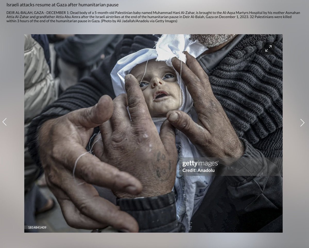 اِبْنِ-آدَم🤍🥀 (@naveedk07179312) on Twitter photo <a href="/jacksonhinklle/">Jackson Hinkle 🇺🇸</a> 🇵🇸 Even the media is debating whether 5-month-old Muhammad Hani Al-Zahar was a doll.
The poor child’s body is going through Rigor Mortis, a postmortem stiffening of the body muscles due to chemical changes in their myofibrils.
What has this war done to us 😢 <a href="/jacksonhinklle/">Jackson Hinkle 🇺🇸</a> 🇵🇸 Even the media is debating whether 5-month-old Muhammad Hani Al-Zahar was a doll.
The poor child’s body is going through Rigor Mortis, a postmortem stiffening of the body muscles due to chemical changes in their myofibrils.
What has this war done to us 😢