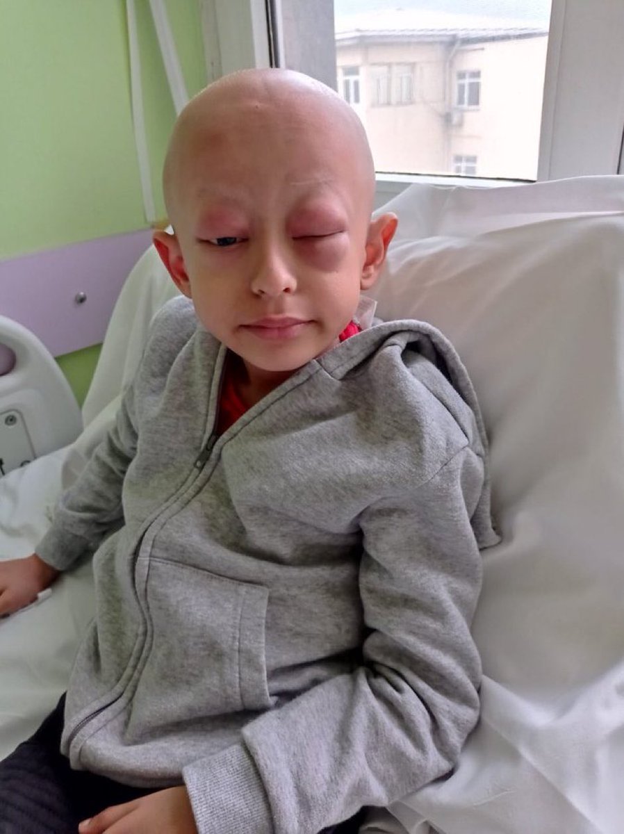 TutsakBebekler's tweet photo. Kanser tedavisi görüyordu 6 yaşındaki Yusuf Kerim, hastane odasında günlerce “Anne” diye inledi, aylarca “Annemi istiyorum!” diye feryat etti.. 
Vicdan sahibi herkes duydu çığlıklarını duyması gerekenler hariç. 
2 Ekim günü hayatını kaybetti!

@Av_Burcu03 
#TenkiliUnutturma https://t.co/I6gT8SnIyj