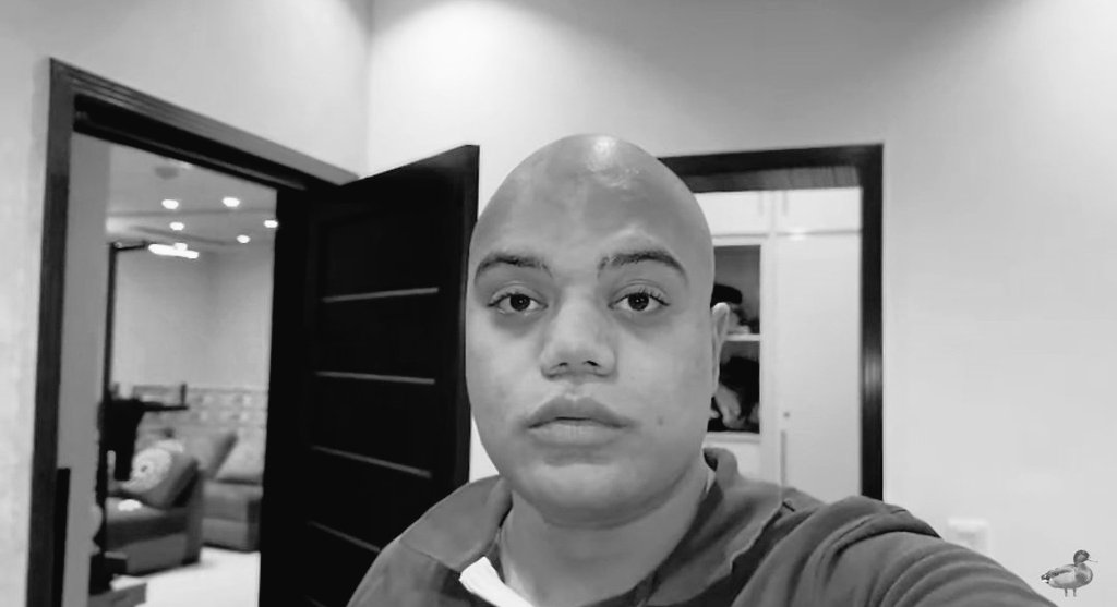 Dwayne Johnson after being bitten on the lips by a hornet.

California 2023