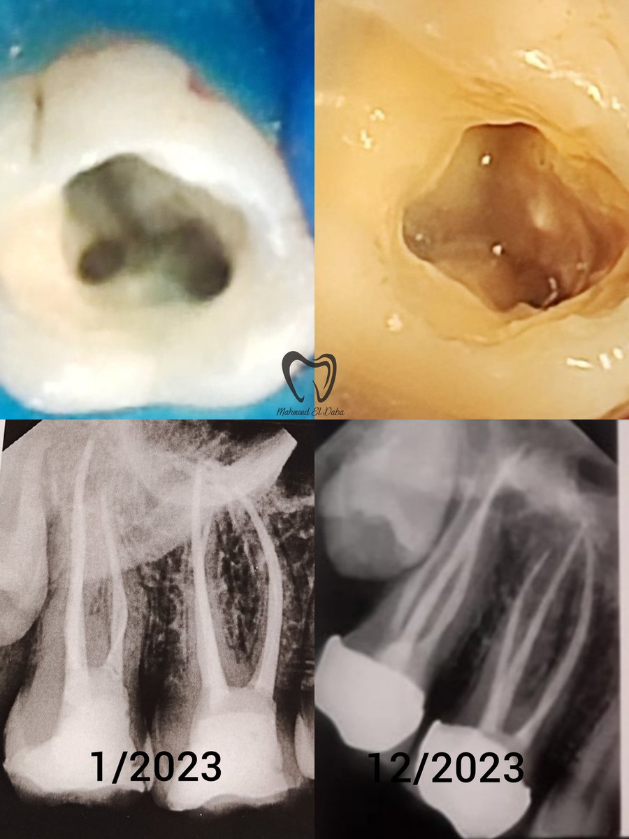 MahmoudElDaba8's tweet photo. 11 months follow up of Rct for UR6 &amp; 7 🙏. 
الشغل دا بفضل الله كان فى مكان حكومى فى بداية امتياز. https://t.co/7pWchQD6bn