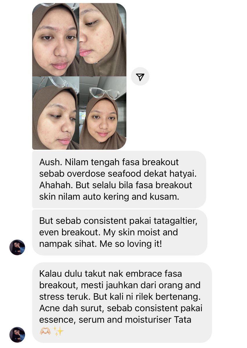 aushmilby's tweet photo. Please cuba our Bertine Moisturising Gel-Cream 🫒 kalau yalls tengah dekat breakout phase.
Nak lagi best combined dengan #TehBunga🌼 + #TehOEssence🍯 both bantu untuk soothing + reduce inflammation and irritation on skin.
Please cuba 🫰🏻 https://t.co/NSf2kV7mkC