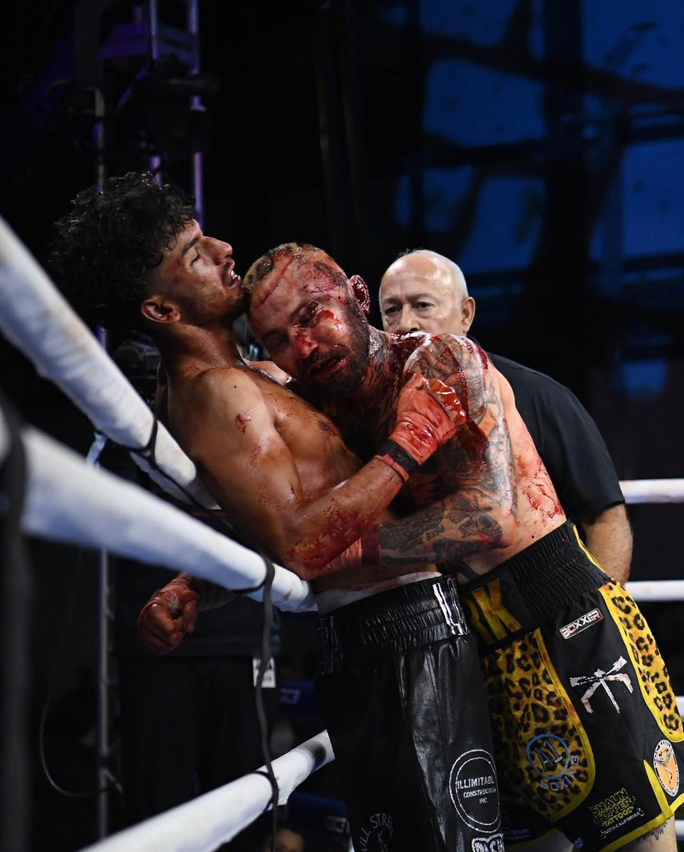 BKB Bare Knuckle Boxing tweet media