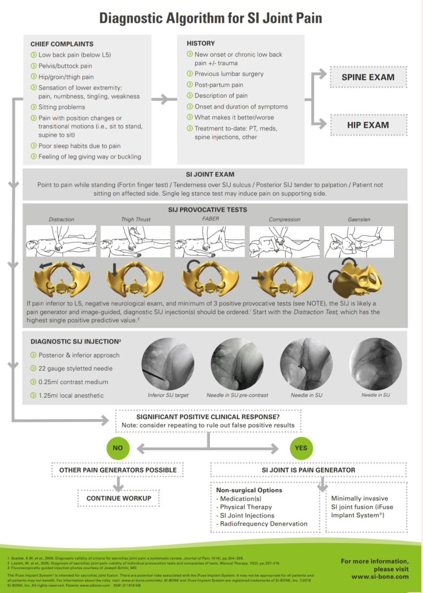SI joint pain is felt in low back &amp; buttocks. 

According to the aafp.org ,Positive responses to at least 3 physical provocation tests suggest SI joint dysfunction&amp; local anesthetic SI joint blocks can also be useful

See the attached algorithm as well