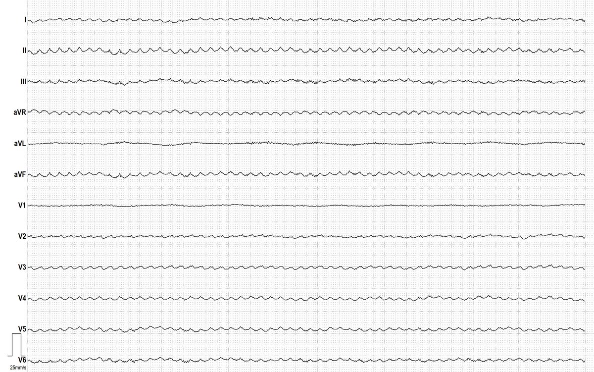 Dr. Andreas Roeschl tweet media