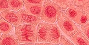 Vosanz's tweet photo. @VegaGEscudero #lamejoranafase #practicamitosis #BCGBMedicinaUAM23_24 Víctor Ortega. en la foto se observan todas las fases importantes de la mitosis. En concreto, en la parte central derecha vemos claramente una anafase (junto a una metafase), orientándose hacia los extremos. https://t.co/bElUsne08R
