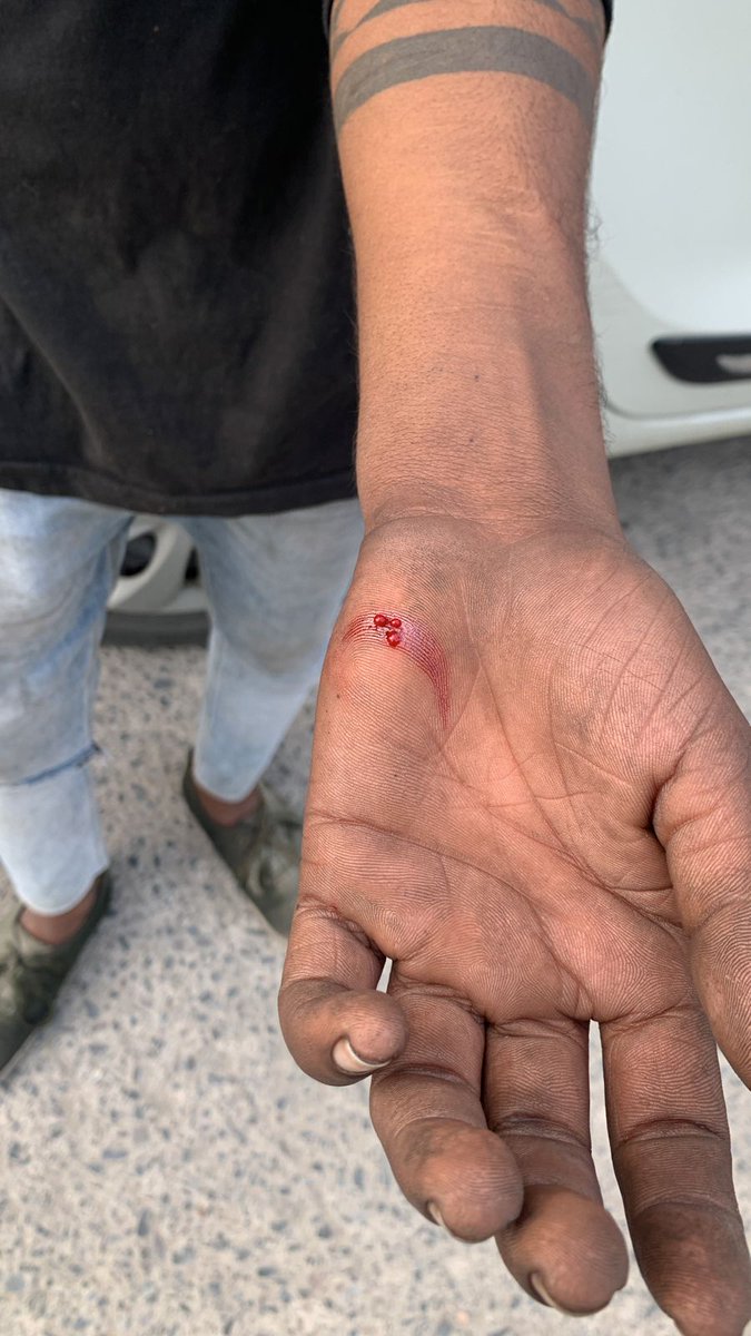ErVaibhav2319's tweet photo. StrayDog menace in #LogixBlossomCounty
#Sector137
@CeoNoida, @noida_authority
@lbcresidents
Stray dogs in the society frequently chase n bite residents. Kids are terrified to cycle. Please do not wait for someone to lose his life, pls remove stray dogs from society URGENTLY. 🙏 https://t.co/4kGhIFhDVz