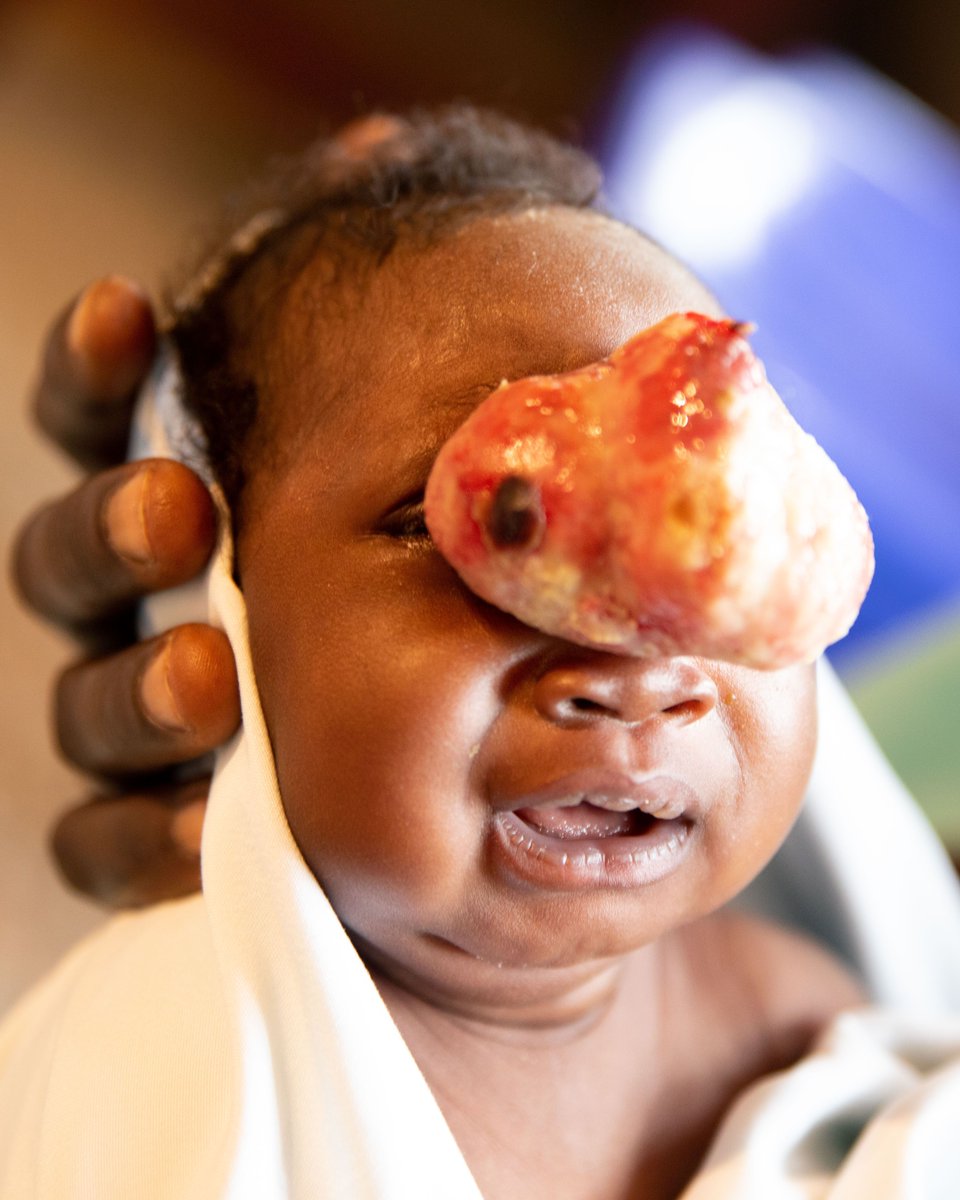 CUREuganda's tweet image. Every child deserves the chance to thrive, and at CURE Uganda, we are committed to creating a nurturing environment that fosters physical healing and spiritual strength.
#InternationalDayOfDisabilities #HealingWithLove #FaithInAction