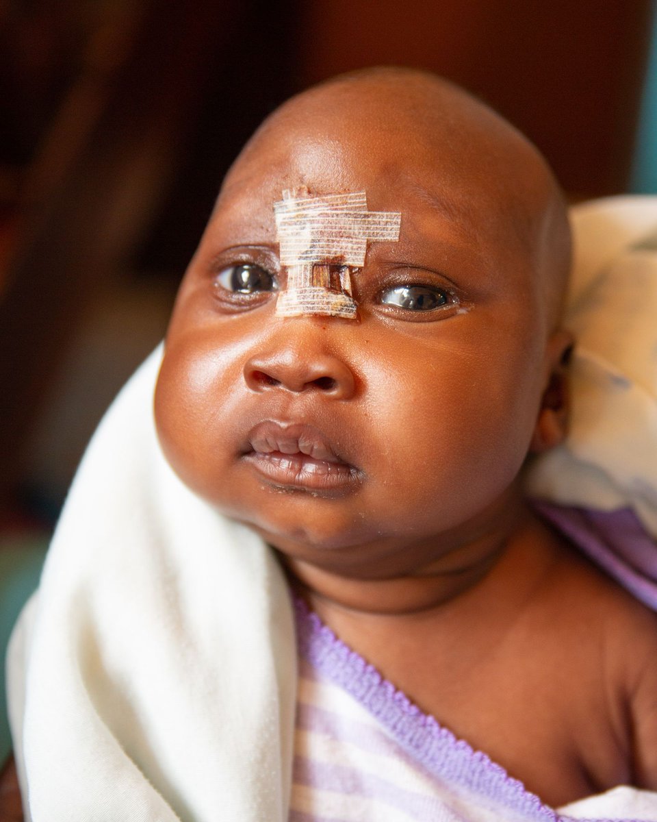 CUREuganda's tweet image. Every child deserves the chance to thrive, and at CURE Uganda, we are committed to creating a nurturing environment that fosters physical healing and spiritual strength.
#InternationalDayOfDisabilities #HealingWithLove #FaithInAction