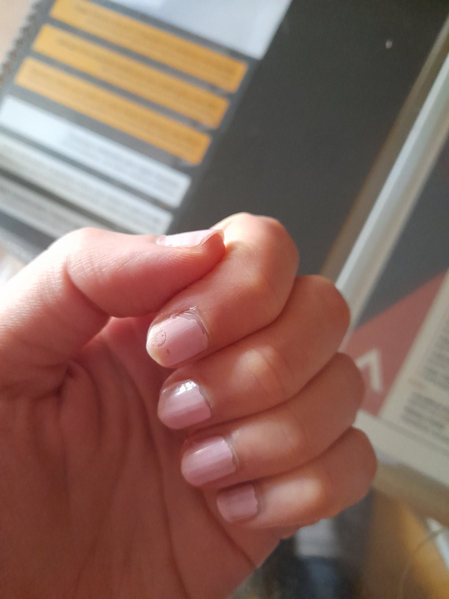mayy266's tweet photo. Quitandome el esmalte rosa de las uñas para que el primer día de trabajo no se den cuenta de que soy un poco especialita https://t.co/LbdmrBbTk7
