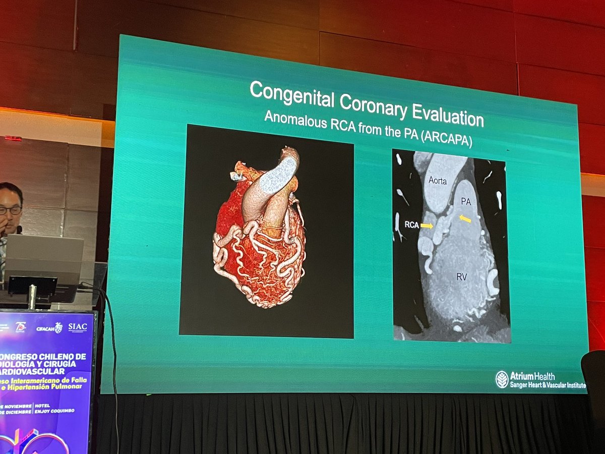 Coronary anomalies discussed too at the @Sochicaroficial by Dr Troy Leo @troyleomd @ACCNCChapter @Sochicaroficial 🇨🇱🇺🇸