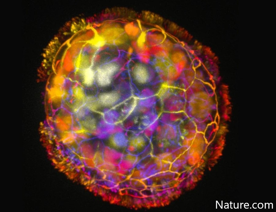 NewsGto's tweet image. 'Anthrobots', human cell robots might help us heal
gtonews.com.mx/anthrobots-hum…
#Anthrobots #HumanCell #Healing #Health #Innovation #Technology #Research #Science #Culture