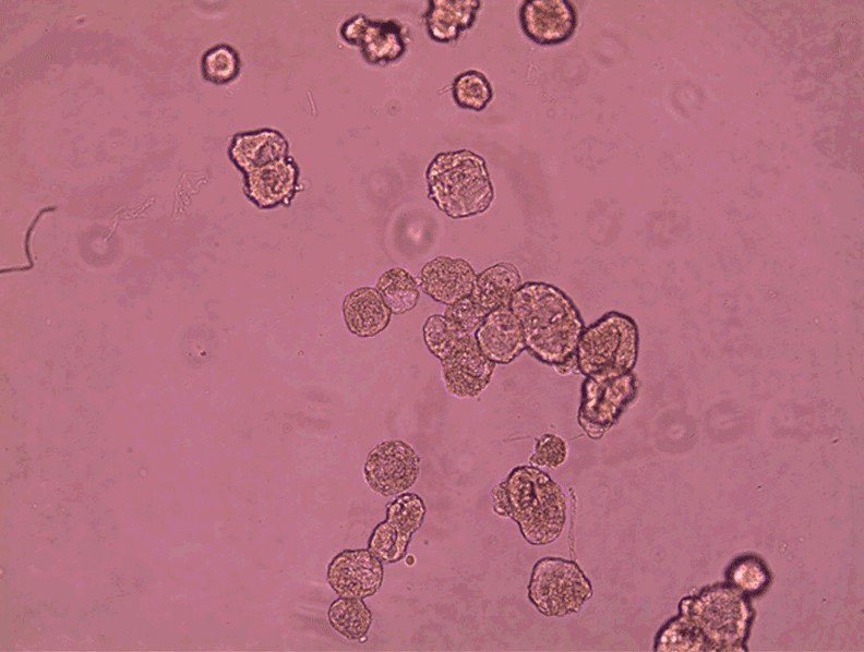 MasGto_'s tweet image. 'Anthrobots', human cell robots might help us heal
gtonews.com.mx/anthrobots-hum…
#Anthrobots #HumanCell #Healing #Health #Innovation #Technology #Research #Science #Culture