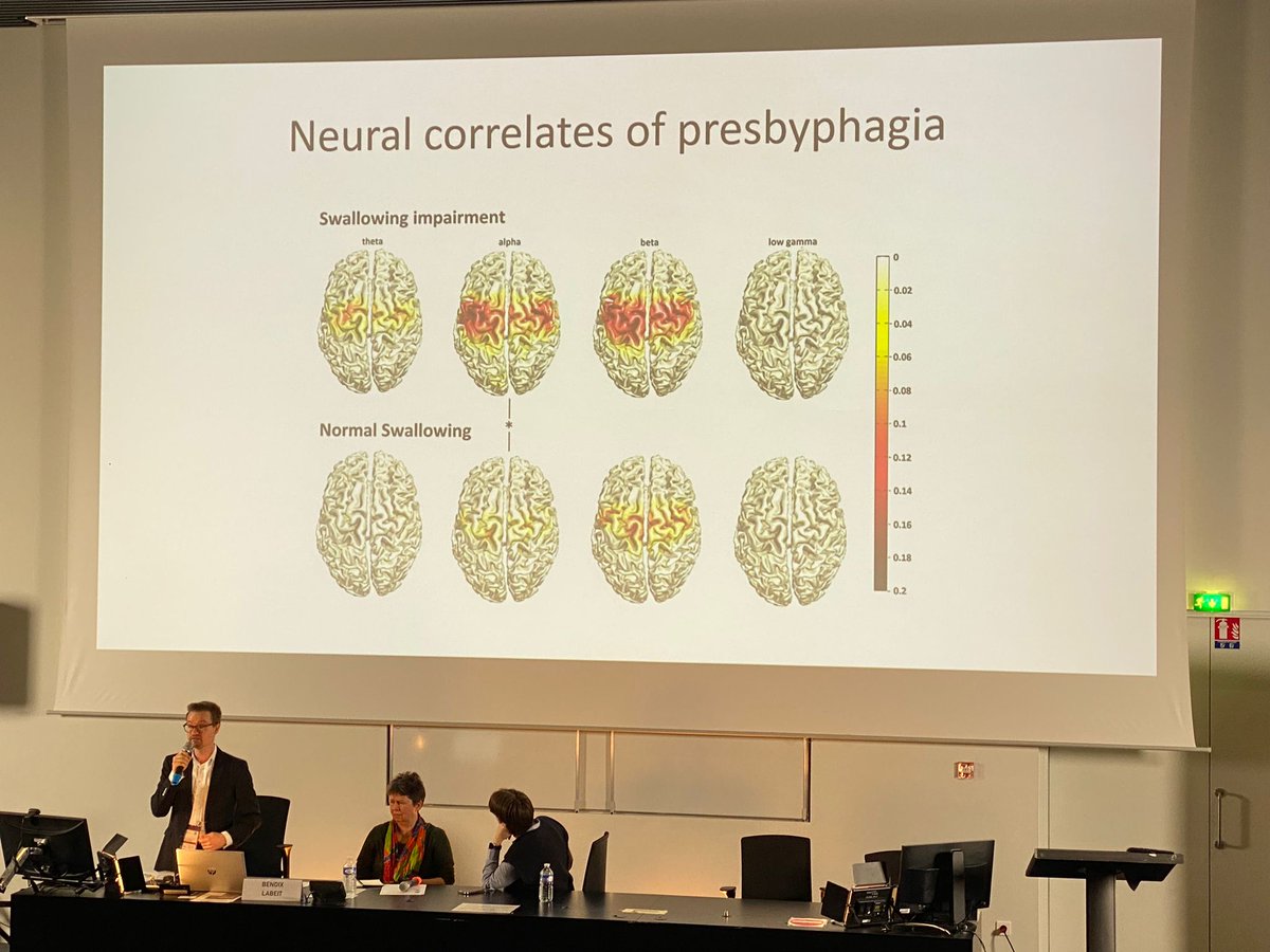BendixLabeit's tweet image. Thrilled to have been part of the joint symposium hosted by the #EuGMS and #ESSD2023. It was a true honor to delve into oropharyngeal dysphagia as a neurogeriatric syndrome, exploring both disease-specific neurological mechanisms and the transdiagnostic geriatric dimension.