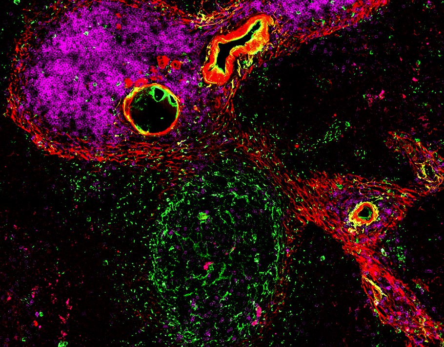 A map of stromal cells in mouse and human #spleen tissue shows an unexpected diversity of cell types supporting immune response. Learn more about the work from 2022: scim.ag/52P #WeekendReads