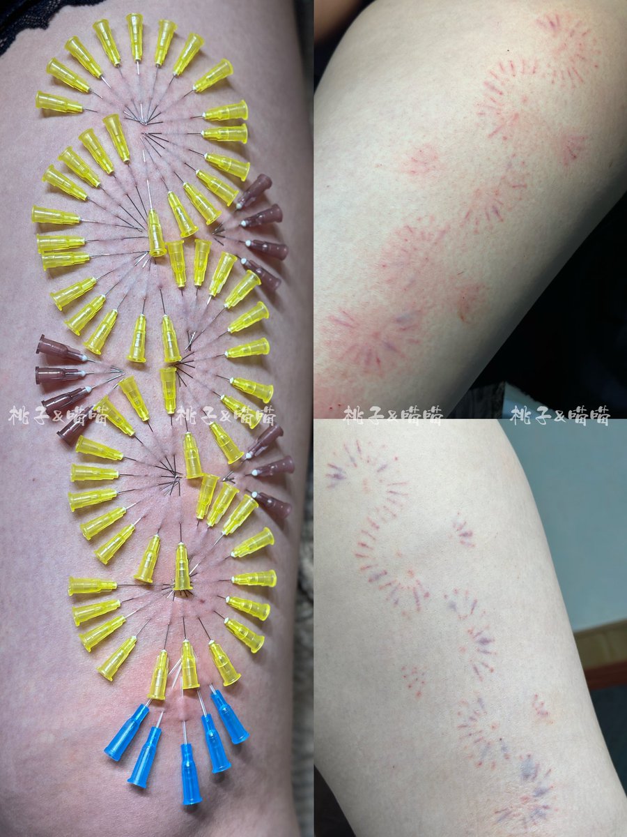 你说爱是什么呢
我说爱是最后留给你的印迹

久违的穿刺局~<a href="/miaomia11111/">喵喵吖～</a> 
#穿刺 #needleplay