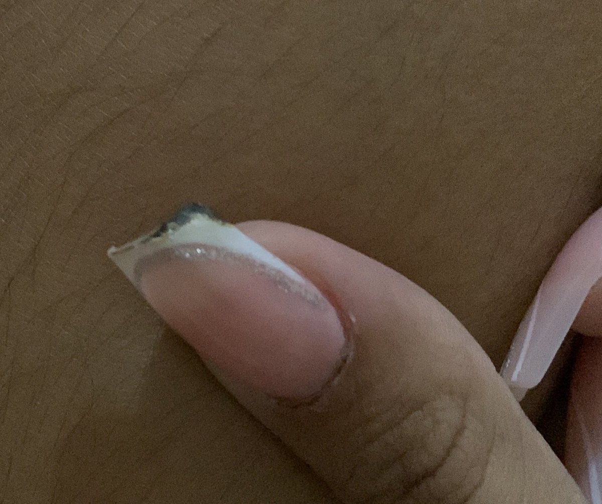 Acr186's tweet photo. En un capítulo más de choco aventuras iba a prender la estufa y me queme la uña😭 https://t.co/ipBExNdlJm