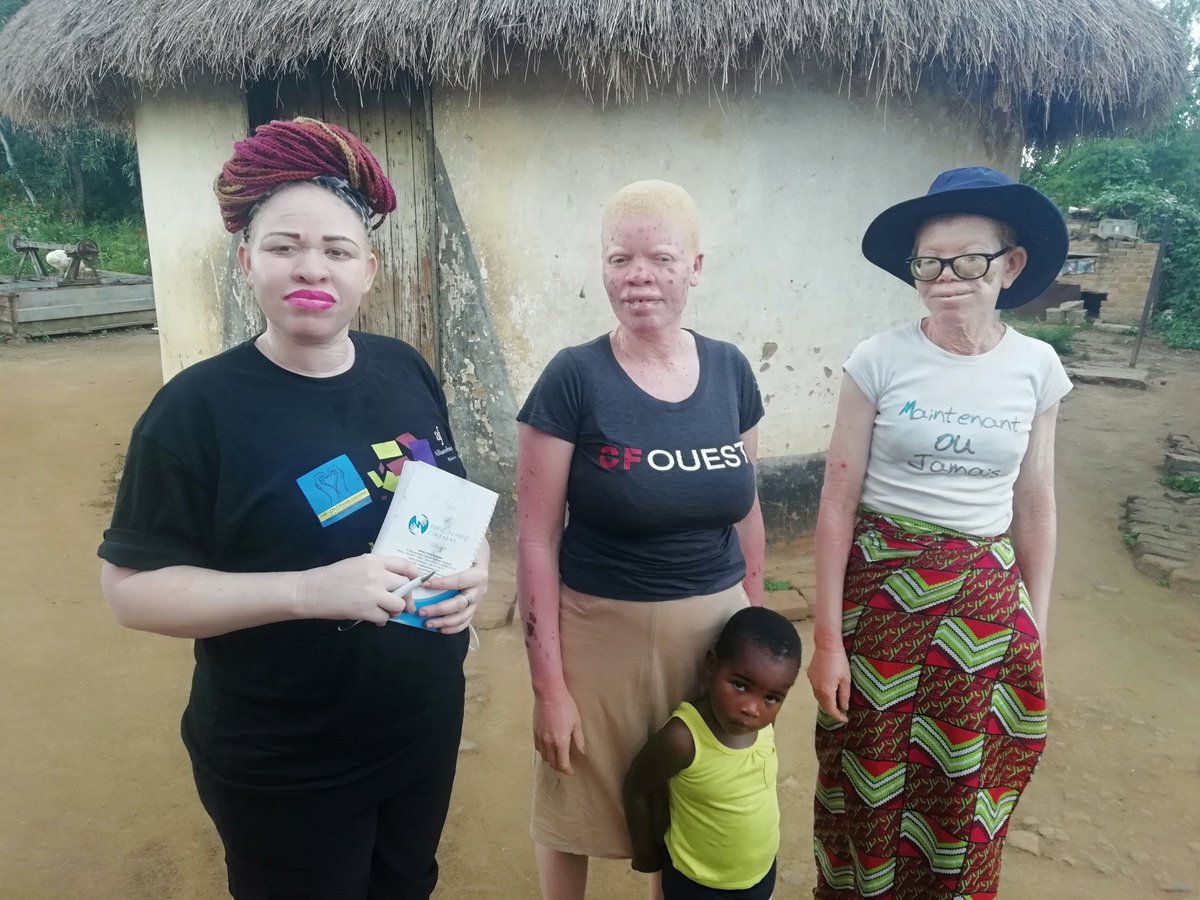 Queen of BaTonga👑 (@the_tonga_queen) on Twitter photo 2021 somewhere in Concession 📍and today we are still pushing the Albinism Konnect Campaign, connecting brothers and sisters with albinism accross Zimbabwe
Just repost kusvika <a href="/hyundaizimbabwe/">hyundaizimbabwe</a> yatipawo ka better than walking kekuti basa riyenderere mberi. Amen 🙏 2021 somewhere in Concession 📍and today we are still pushing the Albinism Konnect Campaign, connecting brothers and sisters with albinism accross Zimbabwe
Just repost kusvika <a href="/hyundaizimbabwe/">hyundaizimbabwe</a> yatipawo ka better than walking kekuti basa riyenderere mberi. Amen 🙏