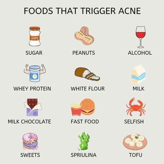 zalyazahari's tweet photo. 4 bulan sebelum Raya ni kurangkan makan makanan bawah ni sebab dia boleh trigger acne 👐 https://t.co/BaeorkOix1