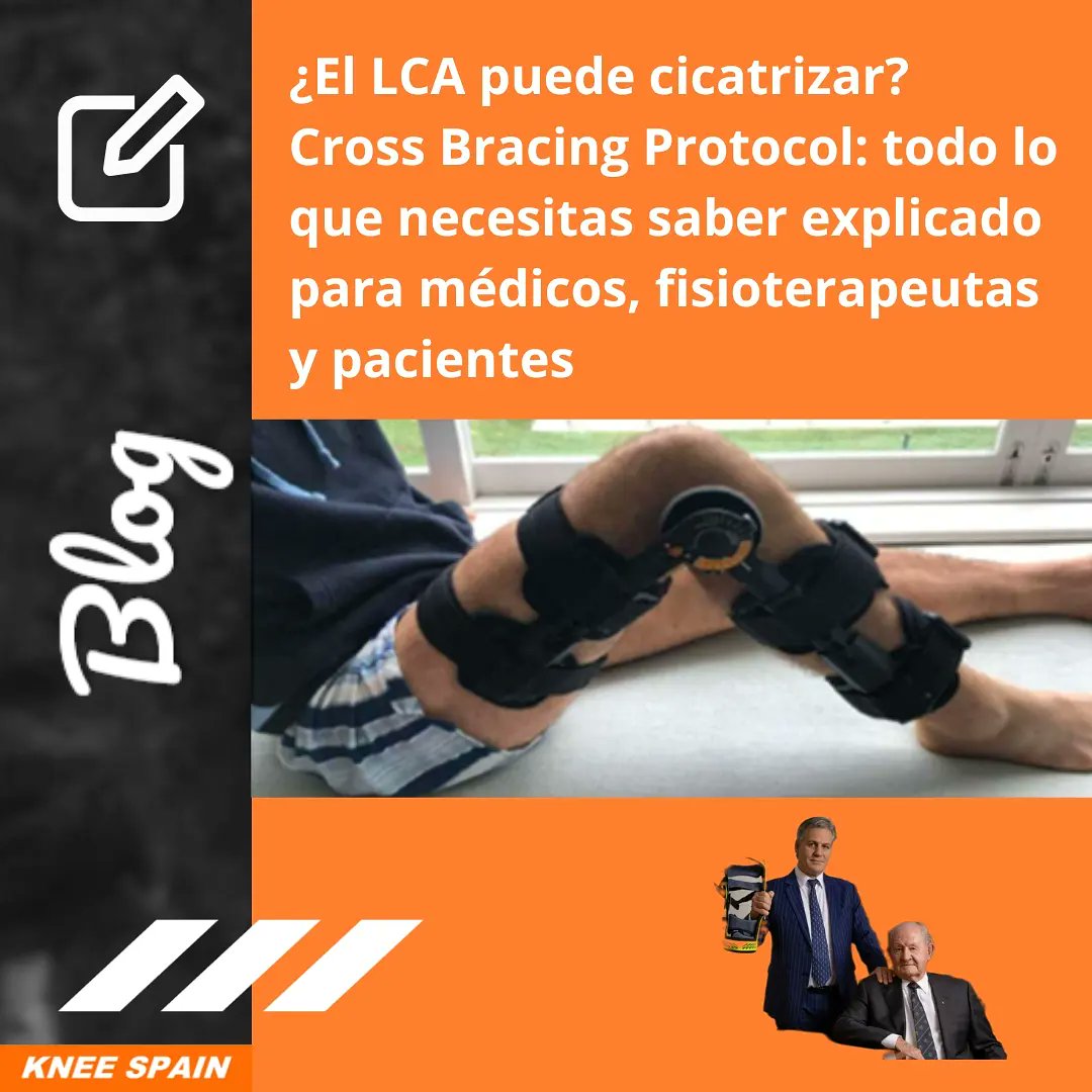 Knee Spain (@knee_spain) on Twitter photo 🇪🇸 ¡Nuevo post en el #Blog!
Sobre uno de los temas más apasionantes que recientemente ha irrumpido en el mundo del #LCA: la publicación de la investigación del #CrossBracingProtocol y su capacidad de cicatrización.
Escrito por <a href="/FisioHockey/">Ana Gacimartín</a> 🖋
kneespainblog.wordpress.com/2023/12/04/el-… 🇪🇸 ¡Nuevo post en el #Blog!
Sobre uno de los temas más apasionantes que recientemente ha irrumpido en el mundo del #LCA: la publicación de la investigación del #CrossBracingProtocol y su capacidad de cicatrización.
Escrito por <a href="/FisioHockey/">Ana Gacimartín</a> 🖋
kneespainblog.wordpress.com/2023/12/04/el-…