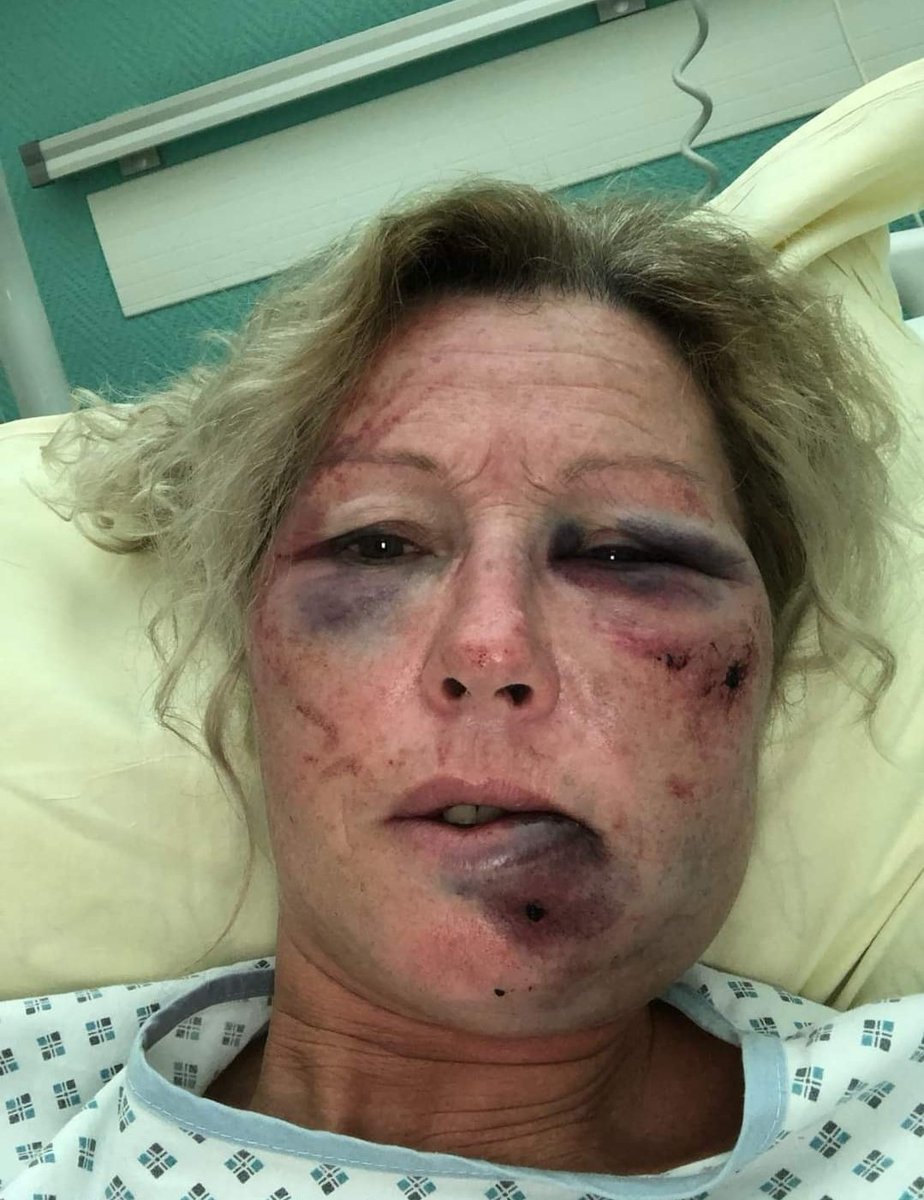 F_Desouche's tweet photo. Maraussan (34). Trois individus entrent de force chez elle : une quinquagénaire laissée pour morte après avoir été rouée de coups
https://t.co/Ud5jHGI5oG https://t.co/rHFGBln9YM