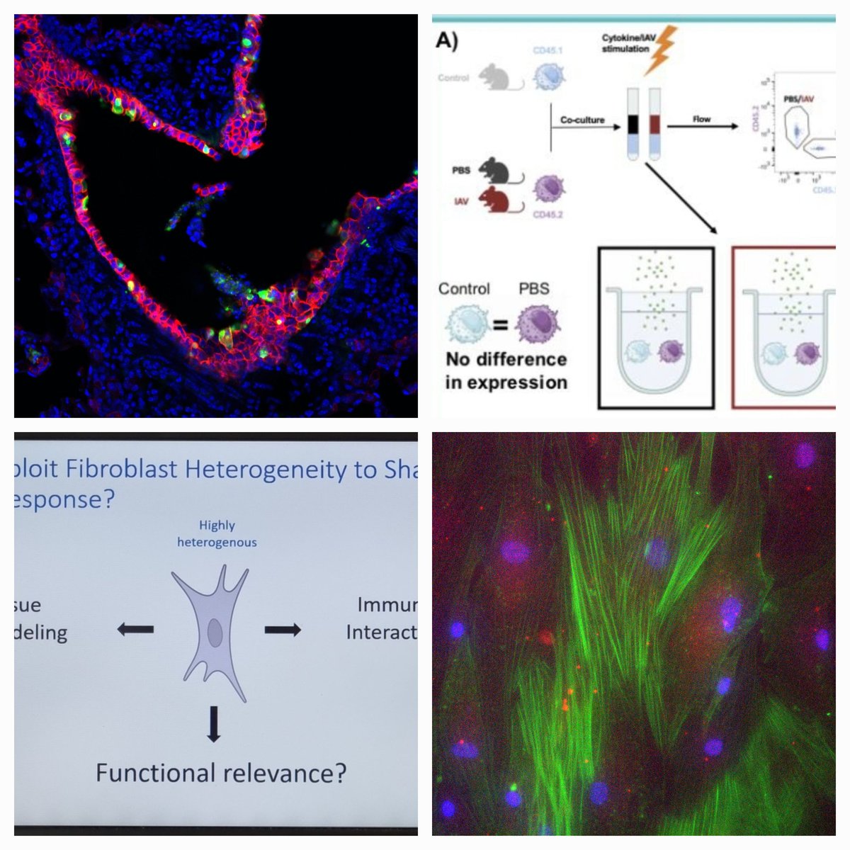 Julie Worrell (@wo_jules) on Twitter photo En route to #BSI23 🤓 #immunologistsonaplane ✈️ check out our posters #417 <a href="/DrJessRoberts/">DrJessRoberts</a> biomaterials&bone #310 <a href="/D_B_Todd/">David Todd</a> NK cells&IAV and if you like fibroblasts, fibrosis and IAV check out my posters #110 and #312 <a href="/bsicongress/">BSI Congress & Events</a> <a href="/LIVE_iiiglasgow/">LIVE</a> <a href="/BALRcommunity/">British Association for Lung Research (BALR)</a> #influenza 🫁 En route to #BSI23 🤓 #immunologistsonaplane ✈️ check out our posters #417 <a href="/DrJessRoberts/">DrJessRoberts</a> biomaterials&bone #310 <a href="/D_B_Todd/">David Todd</a> NK cells&IAV and if you like fibroblasts, fibrosis and IAV check out my posters #110 and #312 <a href="/bsicongress/">BSI Congress & Events</a> <a href="/LIVE_iiiglasgow/">LIVE</a> <a href="/BALRcommunity/">British Association for Lung Research (BALR)</a> #influenza 🫁