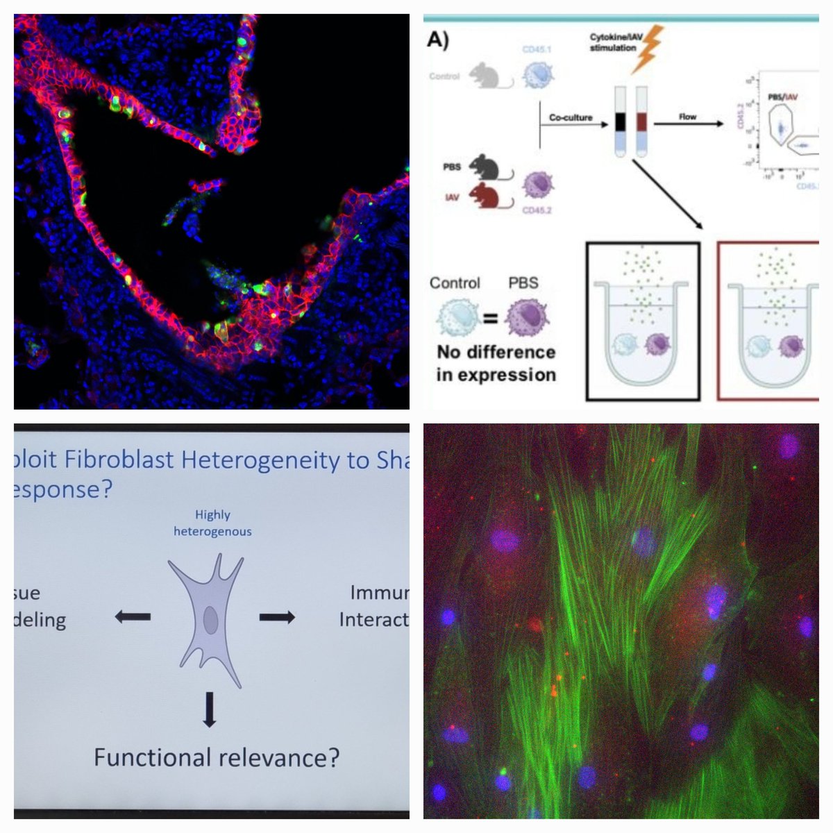 En route to #BSI23 🤓 #immunologistsonaplane ✈️ check out our posters #417 @DrJessRoberts biomaterials&bone #310 @D_B_Todd NK cells&IAV and if you like fibroblasts, fibrosis and IAV check out my posters #110 and #312 @bsicongress @LIVE_iiiglasgow @BALRcommunity #influenza 🫁