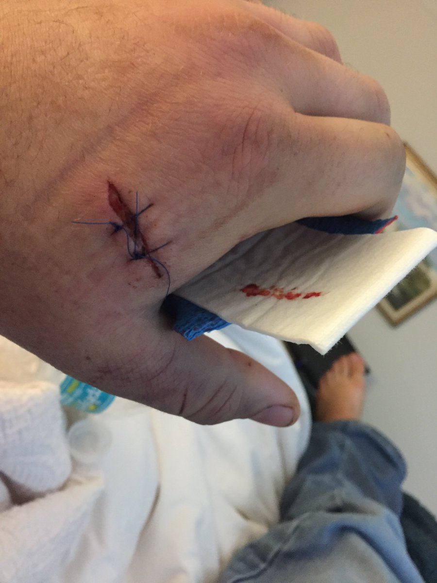 Ross_K_Holmberg's tweet photo. @LasVegasLocally Stabbed by one African American boy in Sarasota, FL - 12/28/16; Merry Fucking Christmas ;) #StraightChillin https://t.co/SmWtXDEBzW