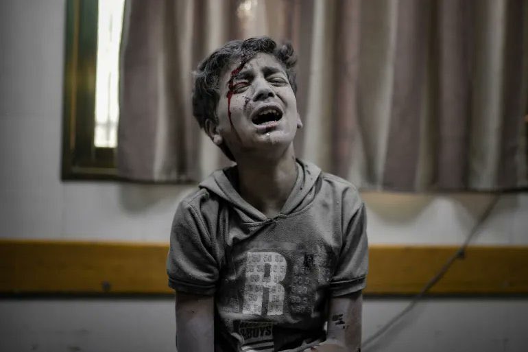 Gazze’de son bilanço:

👉Birleşmiş Milletler iflas etti <a href="/UN/">United Nations</a> 
👉İslam İşbirliği Teşkilatı kendini inkar etti <a href="/OIC_OCI/">OIC</a> 
👉Batı değerleri yer ile yeksan oldu
👉Müslüman dünyası utanç içine gömüldü
👉Dünyanın merhametli halkları sınırları, yasakları, iktidarları ezip “bağımsız vicdan