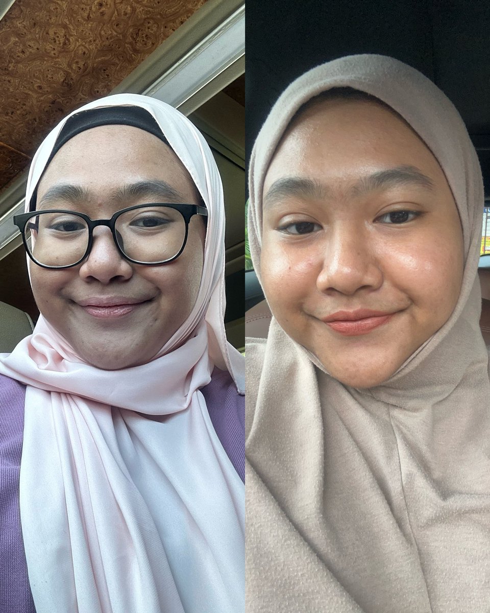 najjihuh's tweet photo. Started using 16PERCENT cleanser &amp; moisturiser. Honestly, my skin has been ✨loving✨ it!

Before: pipi &amp; dahi I kasar, kering. After: Super plumpy, smooth &amp; glowing🫶🩷 https://t.co/oyFoDoWmw3