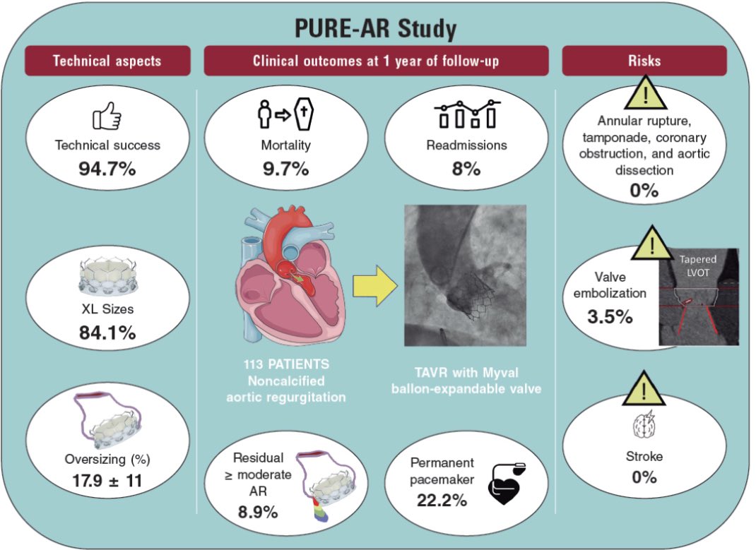 Transcatheter aortic valve replacement for noncalcified aortic regurgitation. Where are we now? recintervcardiol.org/en/editorial/t… #recintervcardiol vía @RevEspCardiol
@jpsanchezluna @TAVRBot @PCRonline @EuroInterventio @secardiologia @shci_sec