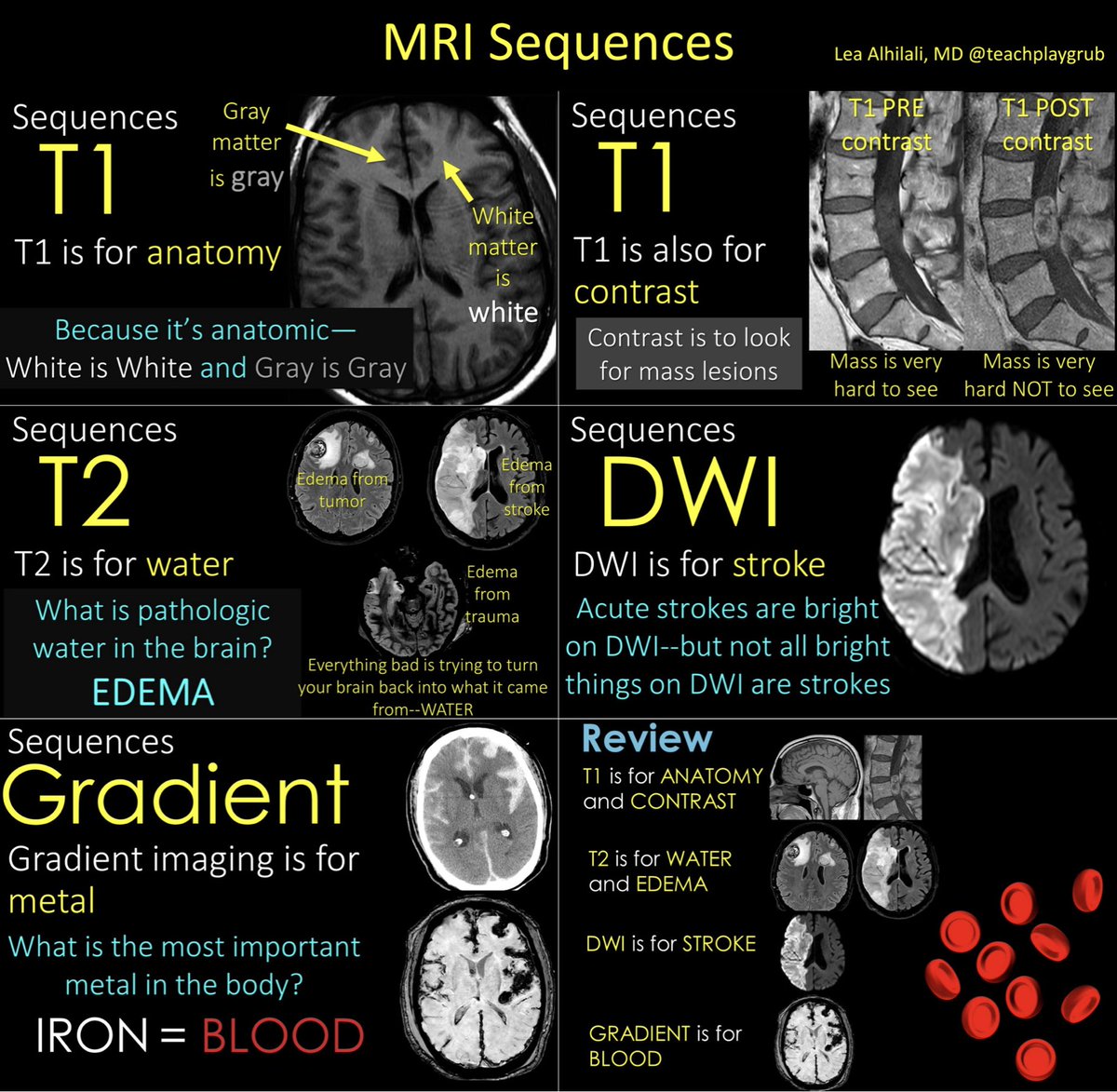 1/If you aren’t cheating, you aren’t trying! Are you looking at MRIs? Feeling some confusion about the diffusion? Feel impaired when it comes to the FLAIR? Wish you could cheat a little? Here’s a little cheat sheet on all the sequences you NEED to know for looking at MRIs!