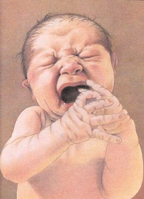 Crying it out: A foundation for NPD and BPD

One of the ways children have to adjust to a new order is called 'letting them cry themselves out'.
 
The Mother puts the child into the crib at night to sleep. It is bedtime. But the sense of aloneness and the loss of contact with the